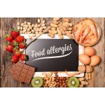 Lebensmittel Allergen Kits