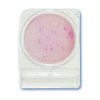 Compact Dry ETB - Enterobakterien